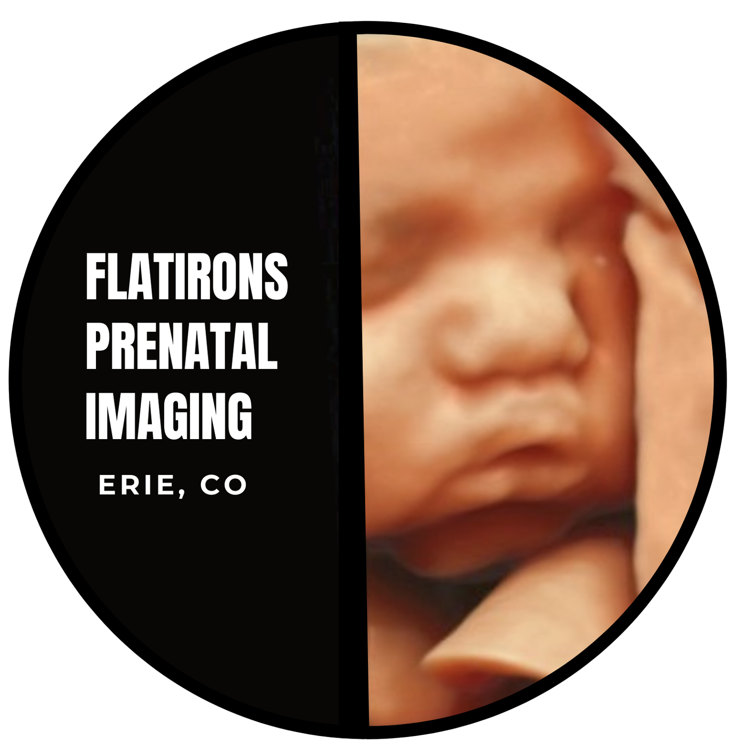 3D 4D Ultrasound Flatirons Prenatal Imaging, Denver's Top Rated on Google